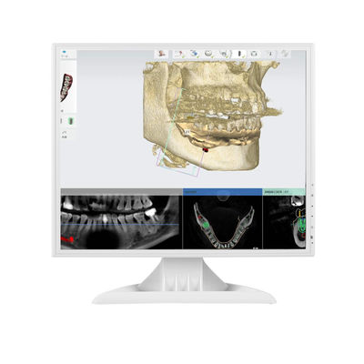 75mm HDMI VGA 17calowy monitor komputerowy LED 4:3 kwadratowy monitor PC